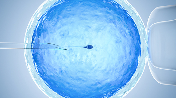 IVF Treatment